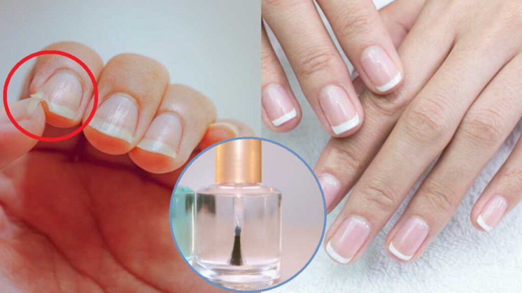 Cómo arreglar uñas quebradizas y débiles