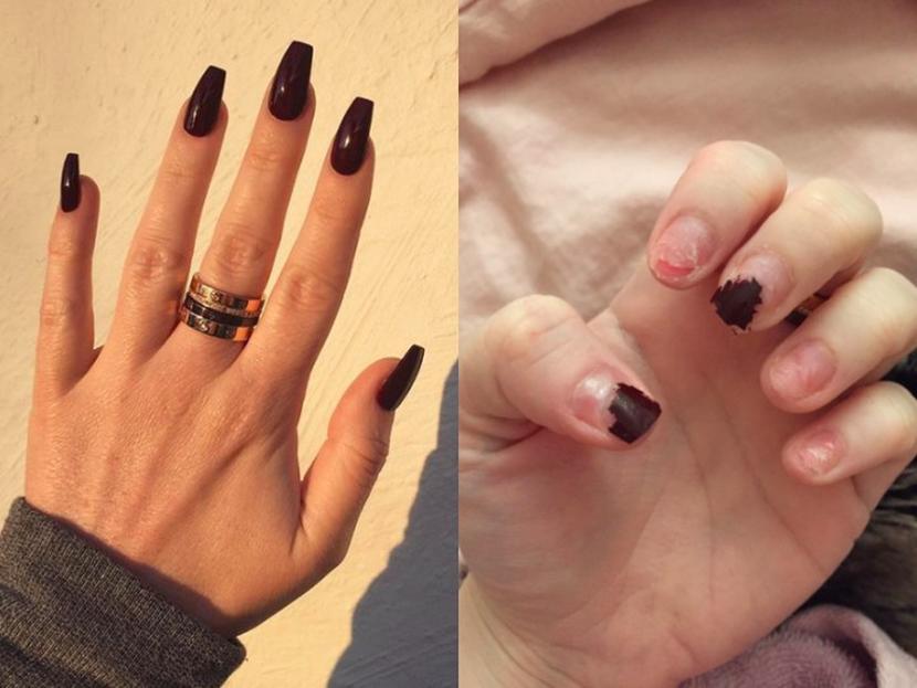 Cómo cuidar tus uñas post-acrílico