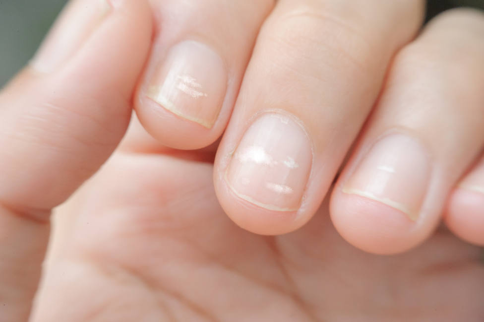 Cómo evitar que las uñas se quiebren y se partan