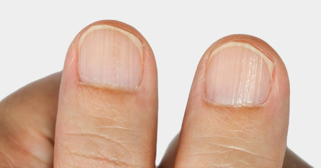 Cómo hacer que tus uñas se vean más largas