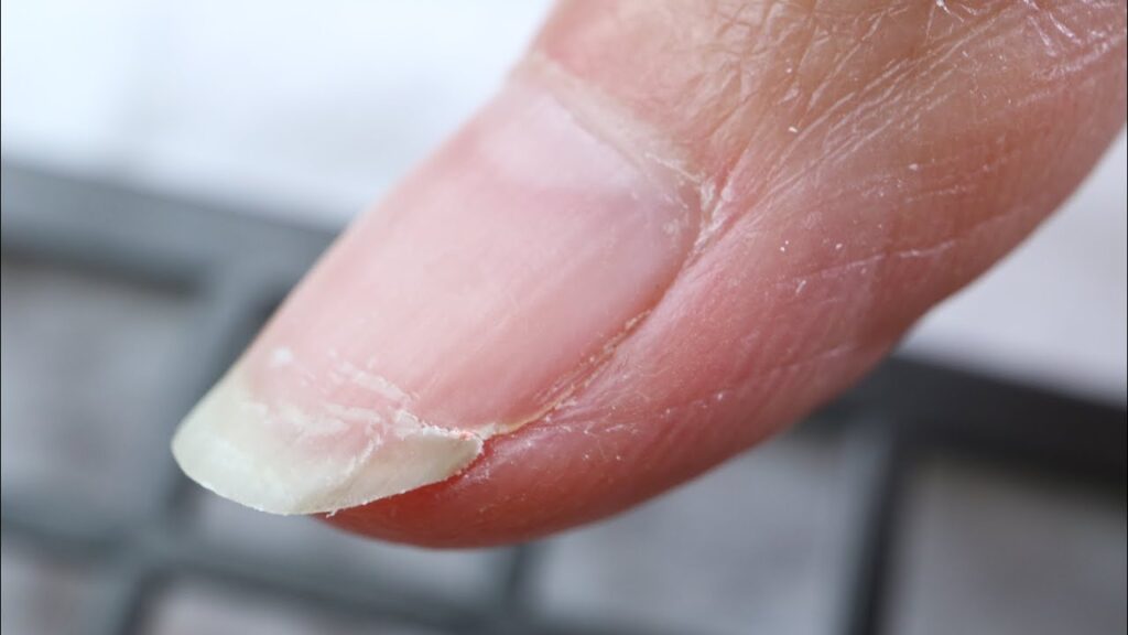 Cómo reparar uñas dañadas por el uso de gel