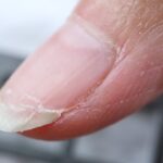 Cómo reparar uñas dañadas por el uso de gel