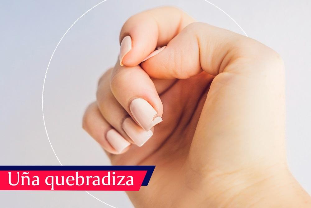 Consejos para evitar las uñas quebradizas