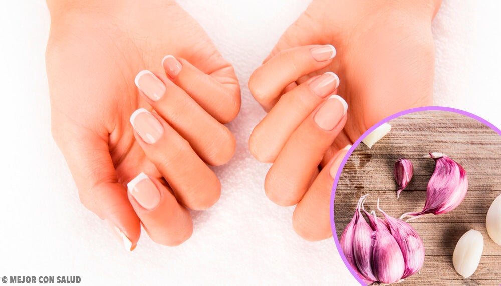 Consejos para prevenir y tratar las uñas quebradizas